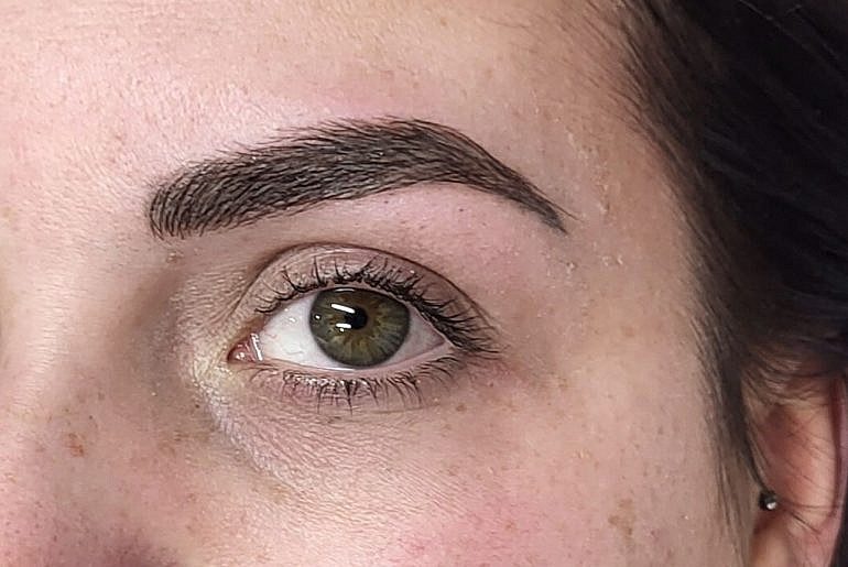 microlading montpellier avant apres missdelph beaute