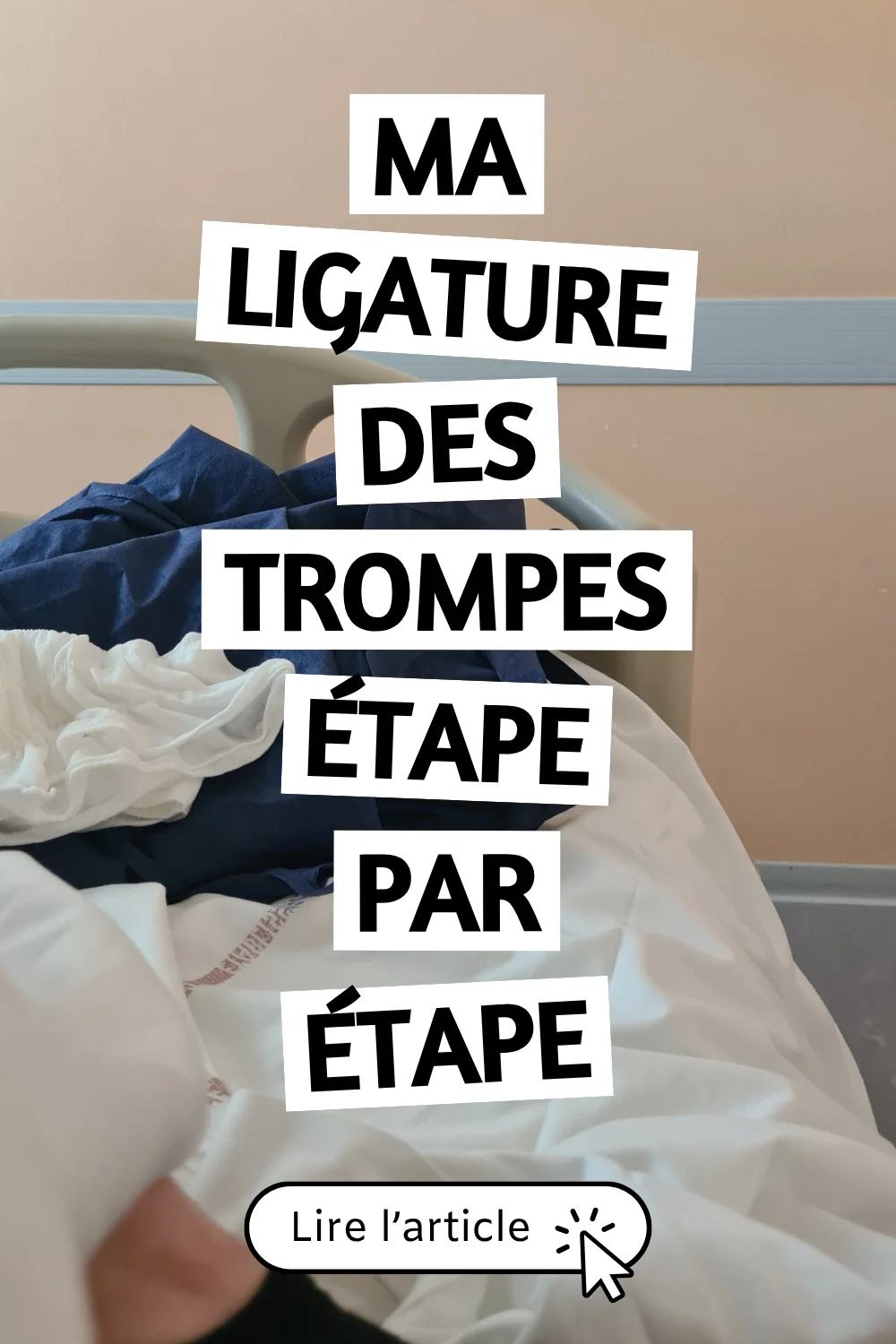 Ma ligature des trompes étape par étape